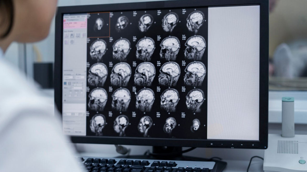 Признаки деменции Пратчетта могли скрываться в его книгах за годы до диагноза Анализ лексики в серии «Плоский мир» показал, ч...