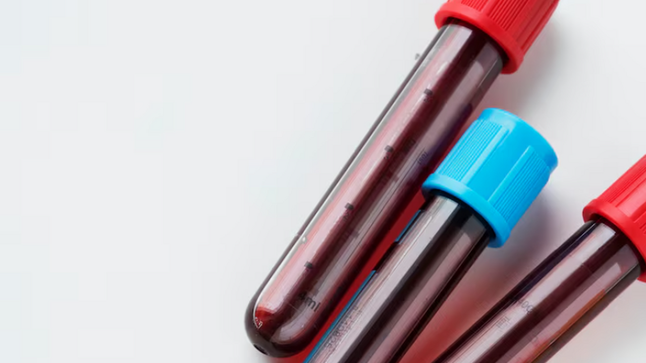 В России завершили клиническое исследование CAR-T препарата от рака крови Клинические исследования CAR-T препарата «Утжеф...