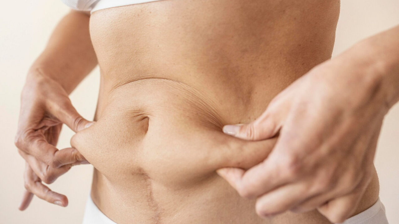 Врач Онищенко предупредил россиянок об опасности процедуры липосакции Геннадий Онищенко заявил, что липосакция может ...