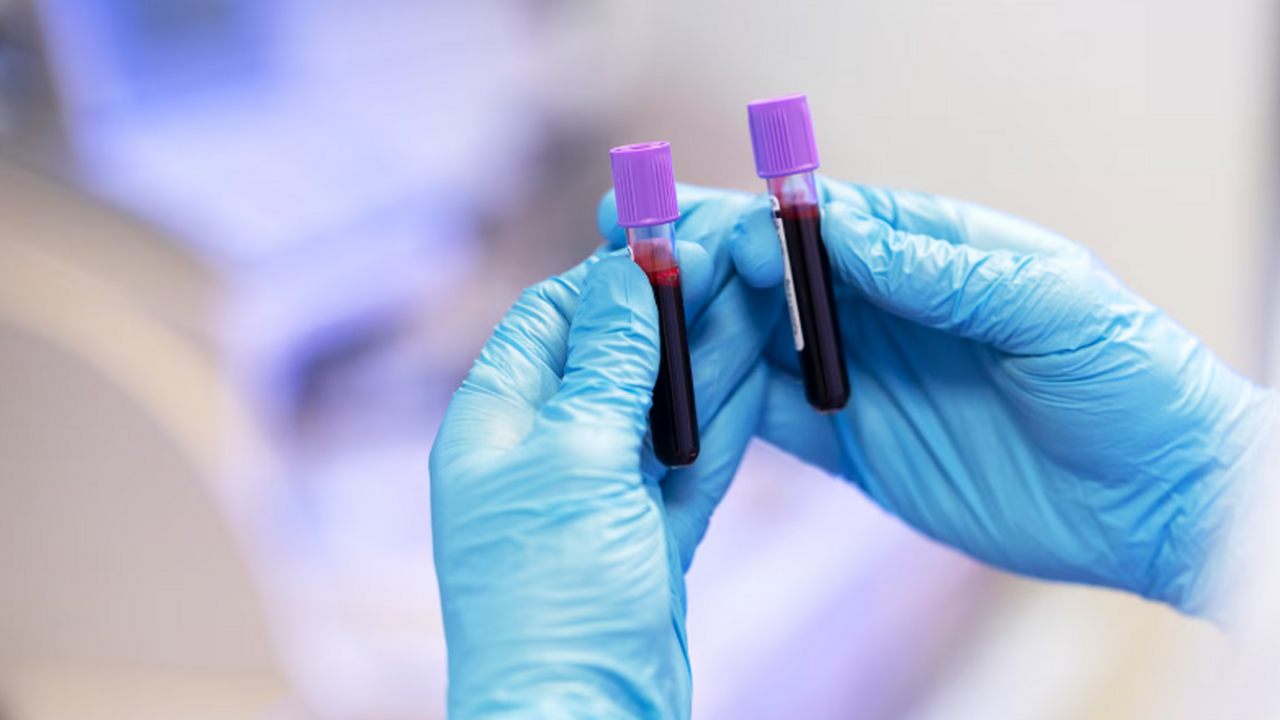 Речь идет о группе крови: ученые определили самую «сильную» Первая группа крови может быть связана с более ...