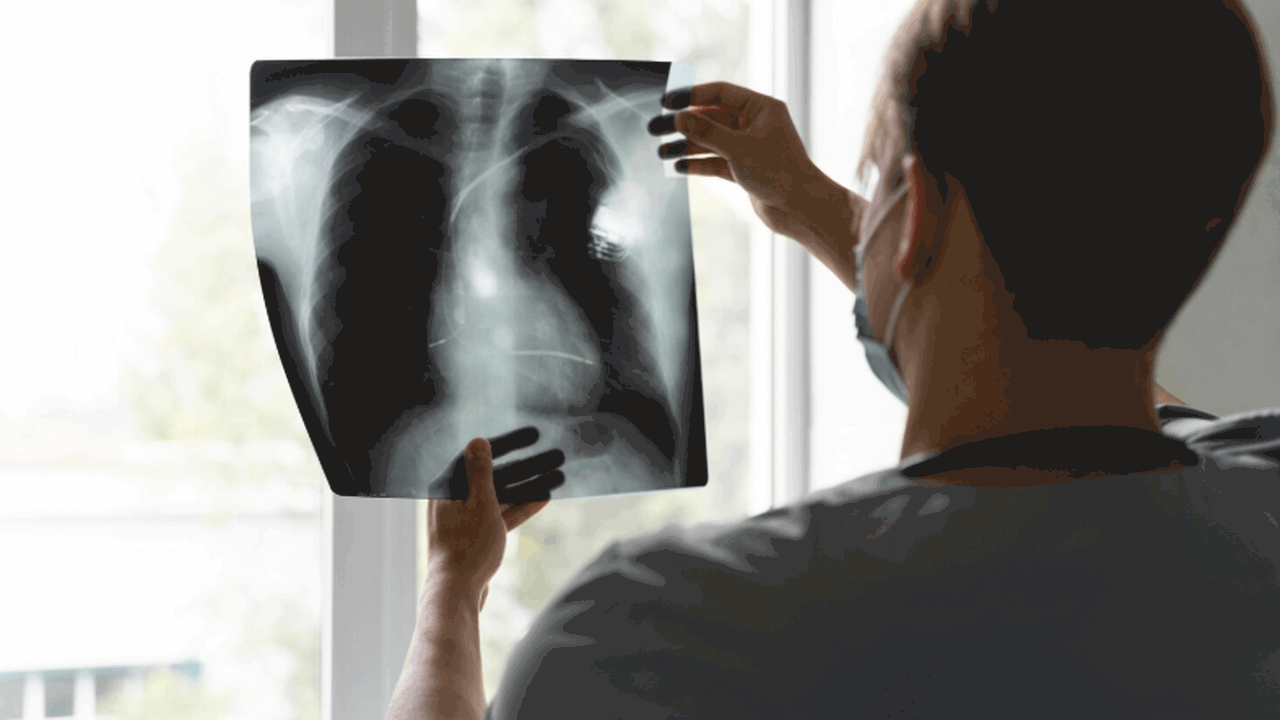 Эксперт ТАСС сообщила о новых способах диагност...