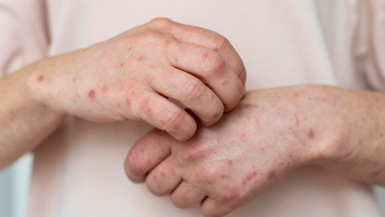 Три страны Африки южнее Сахары объявлены свободными от кори и краснухи ВОЗ сообщила, что Кабо-Верде, Маврикий и Сейшел...