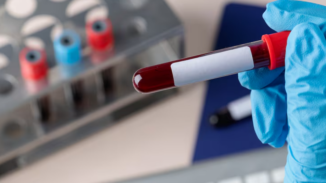 Учёные выяснили, что лечение подагры аллопурино...