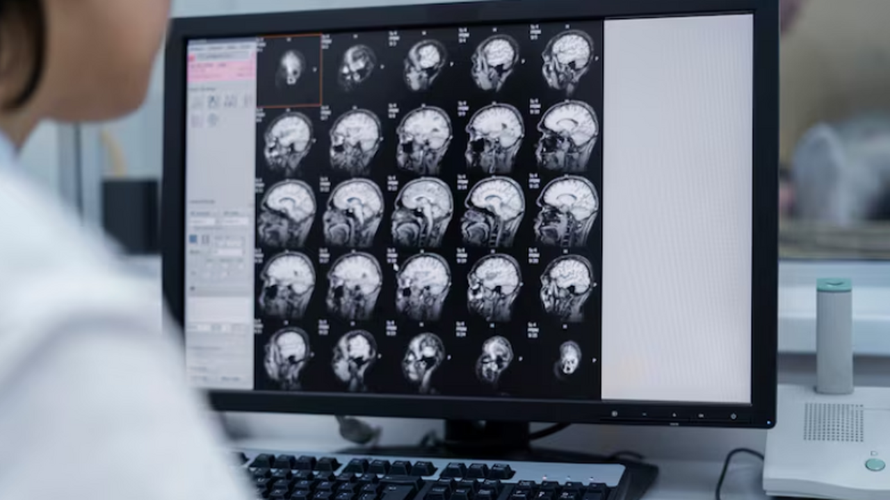 Недавние инфекции часто предшествовали инсульту у детей и подростков Ученые выявили связь между недавними инфекциями...