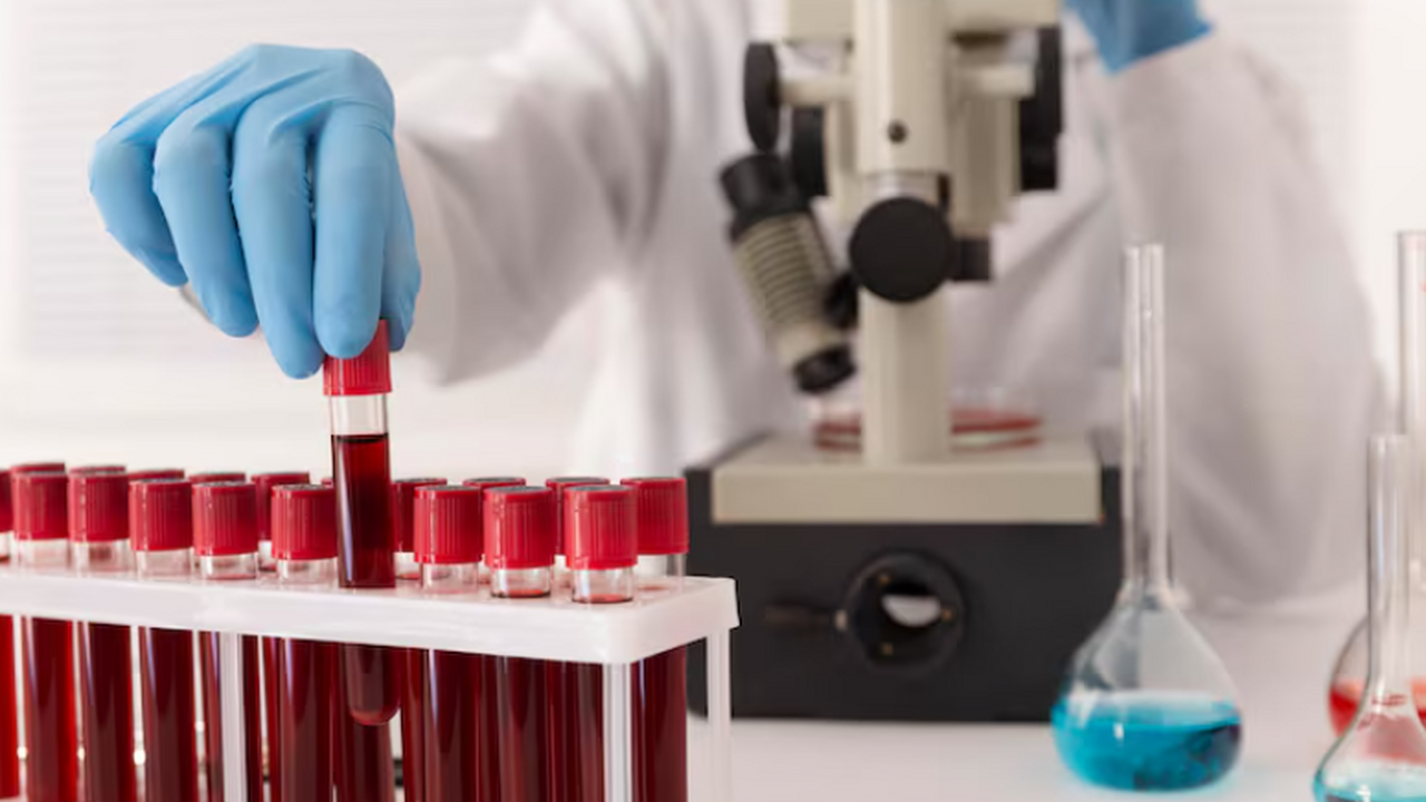 Пересадка стволовых клеток от брата привела к ремиссии ВИЧ у пациента Осло После пересадки стволовых клеток от брата у пац...