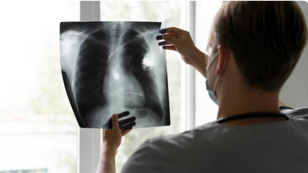 Учёные: вдыхание дезинфицирующих спреев может разрушать лёгкие Исследование Калифорнийского университета показ...