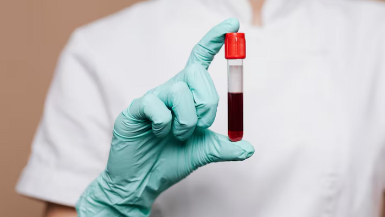 Микросгустки и NET‑сети: новый след в разгадке механизма «долгого COVID» У пациентов с «долгим COVID» количество микросг...