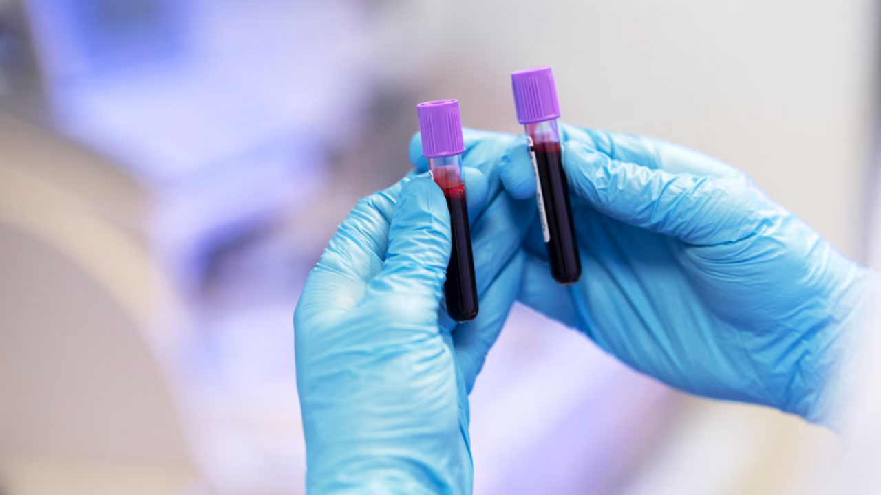 ApoB-анализ показывает более точный риск сердеч...