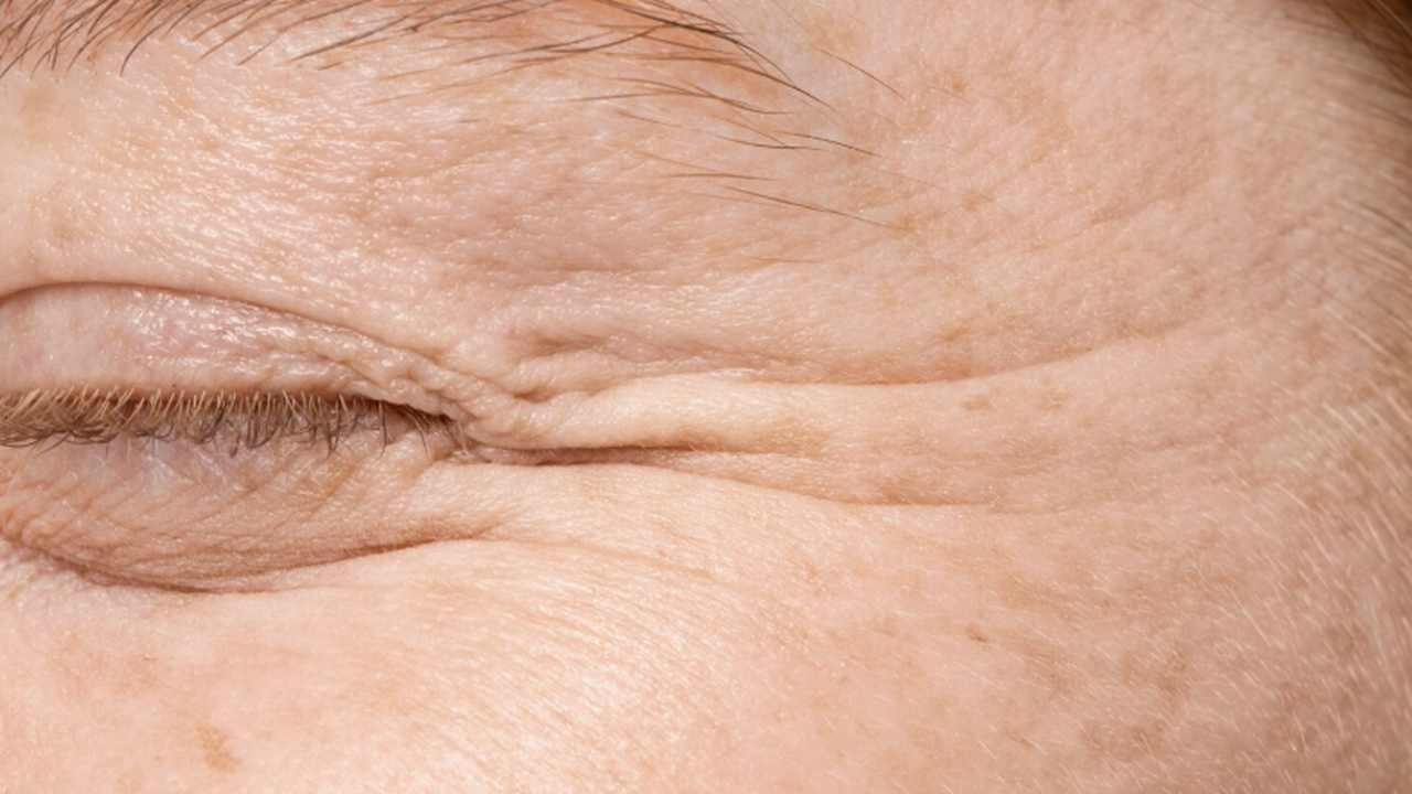 Антивозрастной спермидин способен ускорять рост раковых опухолей Исследование Токийского университета науки пока...