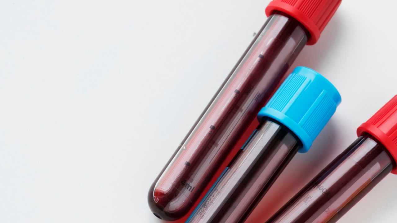 Самарская область стала одним из регионов с сам...