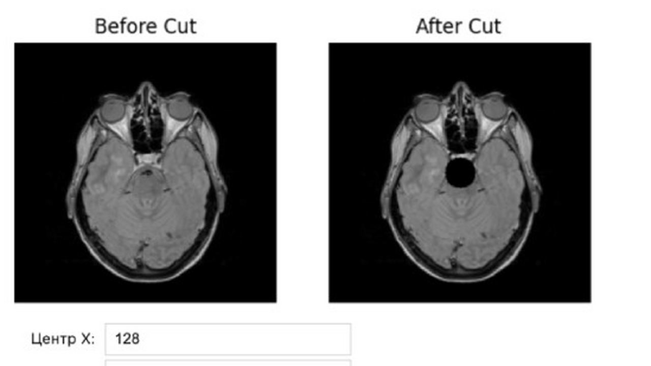 Система уже применяется для подготовки диагност...