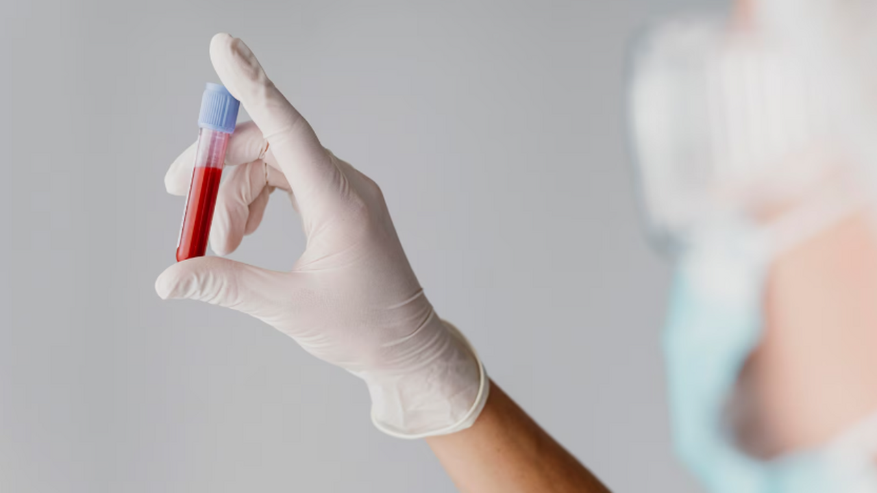 The Conversation: по анализу крови оценят риск смерти через 5–10 лет Эксперты рассказывают о разработке, которая при...