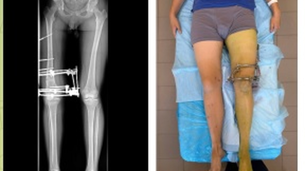 Сейчас пациент проходит активную реабилитацию