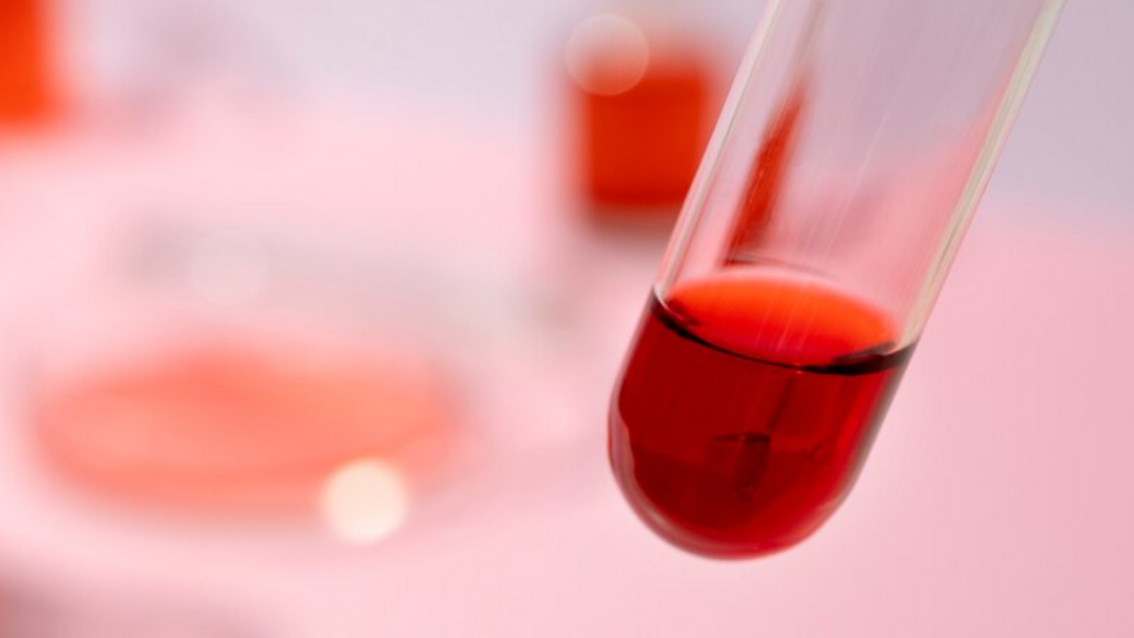 Ученые получили новые данные о том, что возраст...