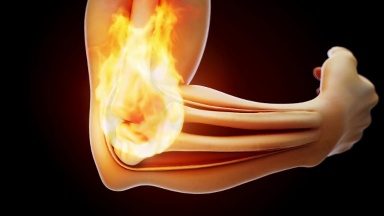 Исследователи установили, что развитие тендиноп...