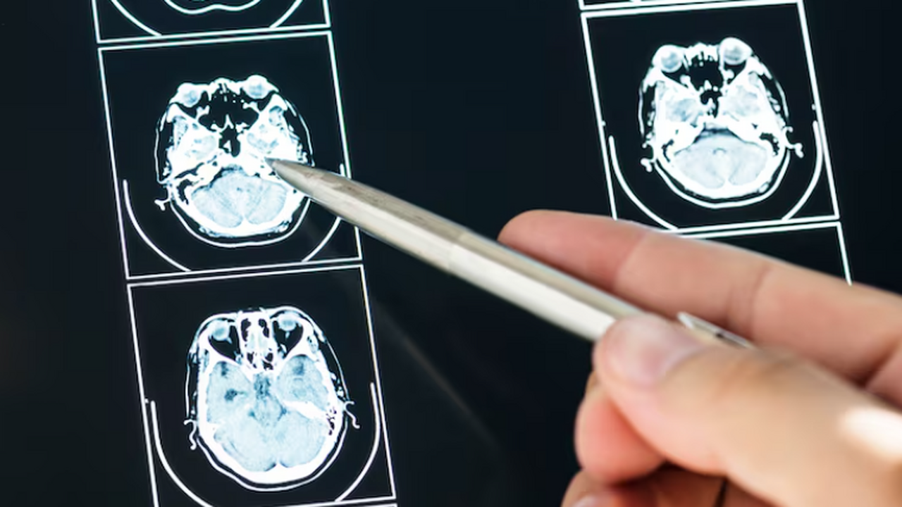 Американские исследователи показали, что коррек...