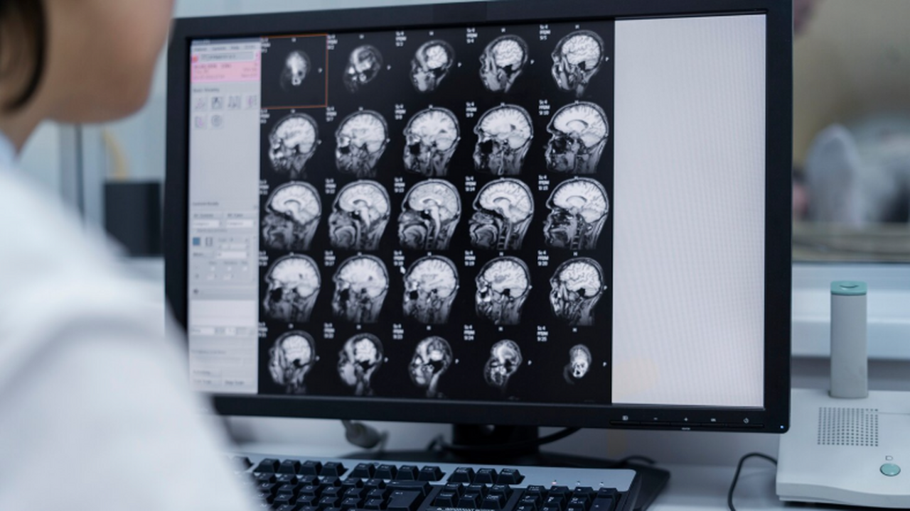 Опасен для мозга: популярный пестицид связали с риском Паркинсона Исследование показало, что широко применяемый в...