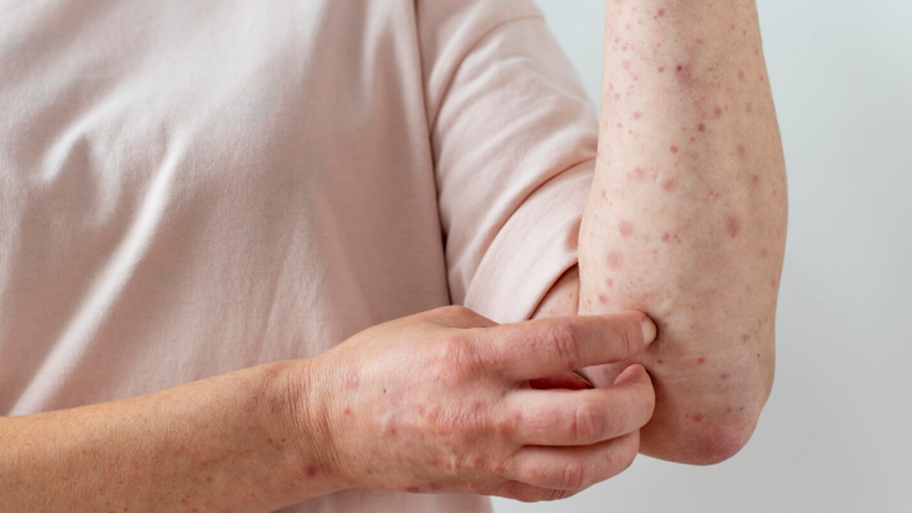 Врач-инфекционист Елена Мескина советует избега...