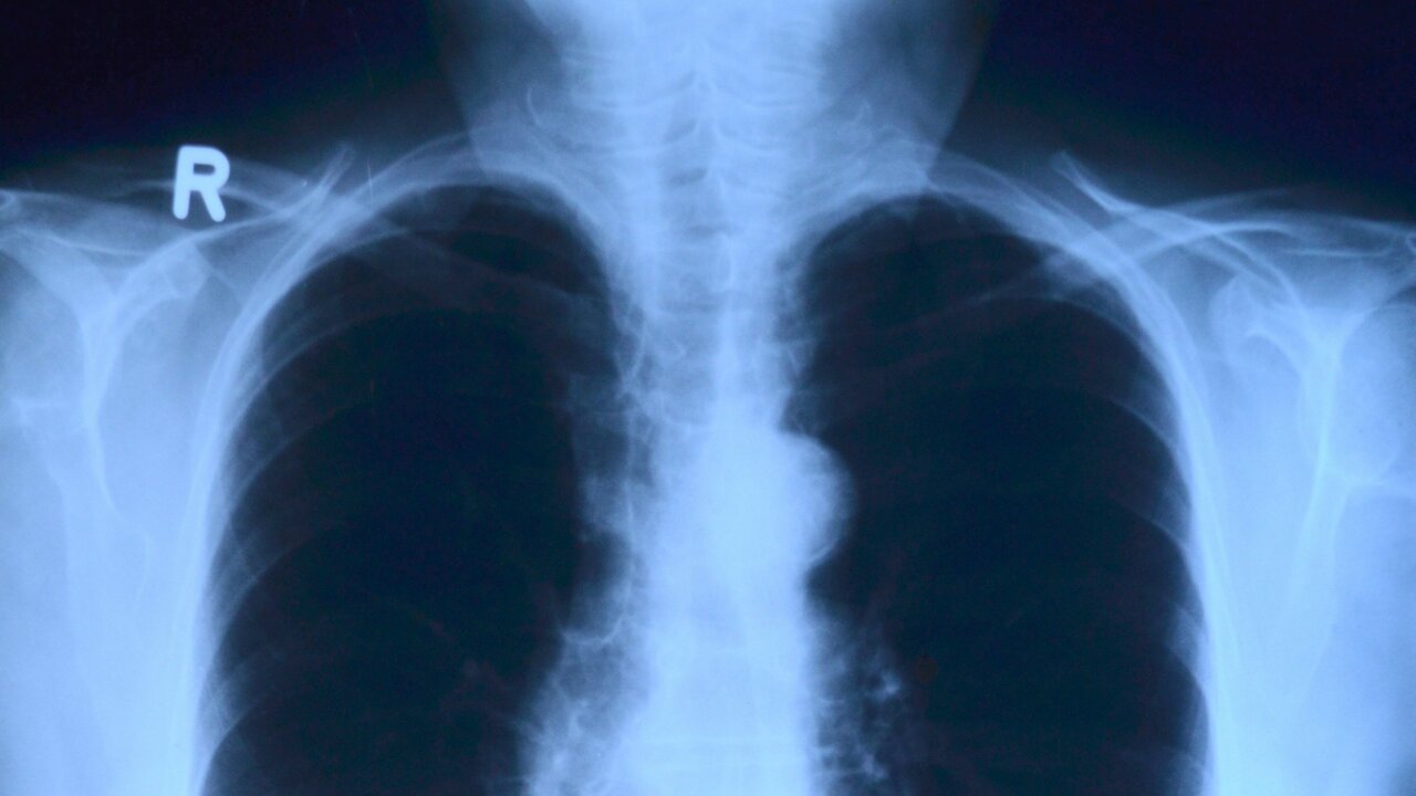 Врачи связывают это с изменением образа жизни и...