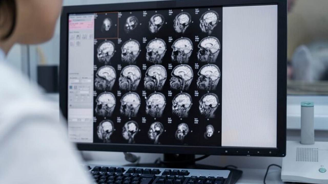 Семилетний пациент умер от подострого энцефалит...