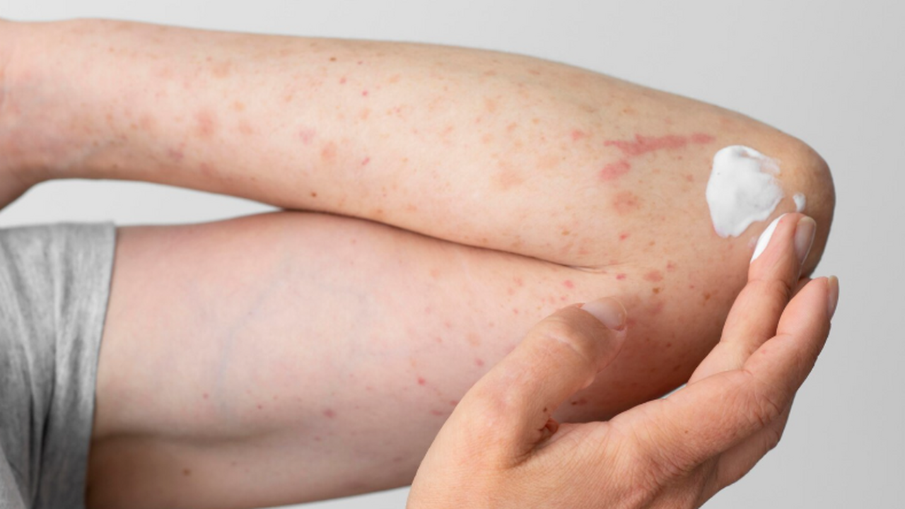 Эксперт Геннадий Онищенко заявил, что рост числ...