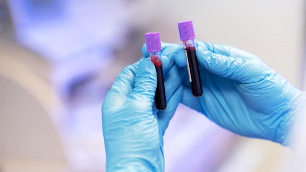 У супердолгожителей, доживших до 100–110 лет и ...