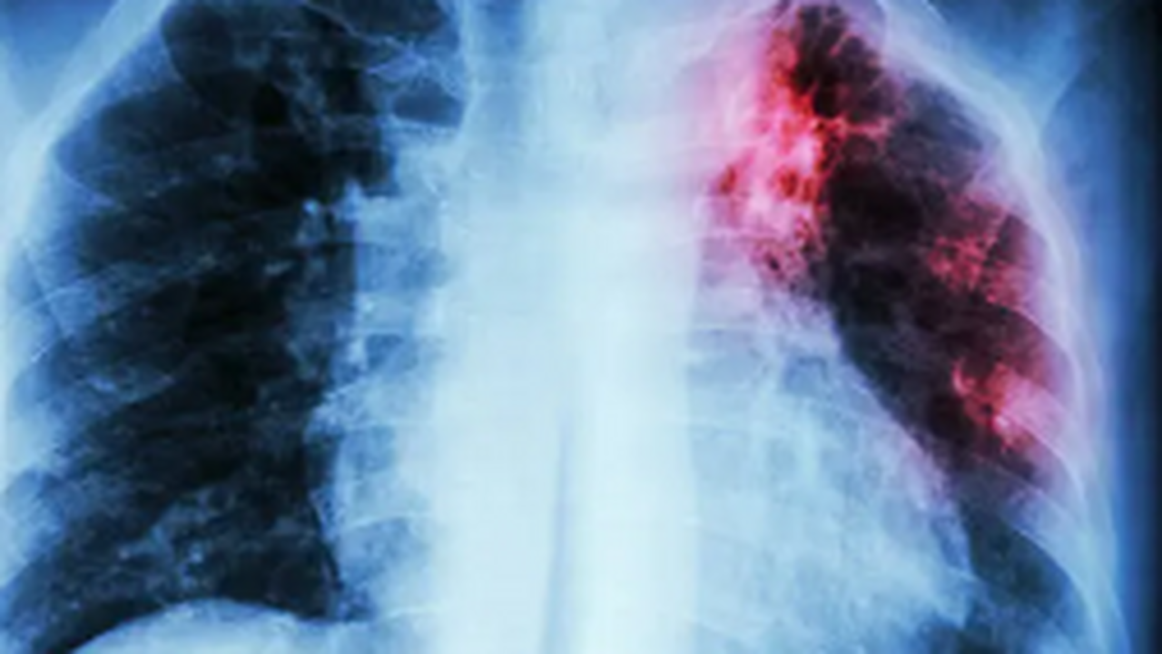 Специалисты советуют не пренебрегать профилактикой