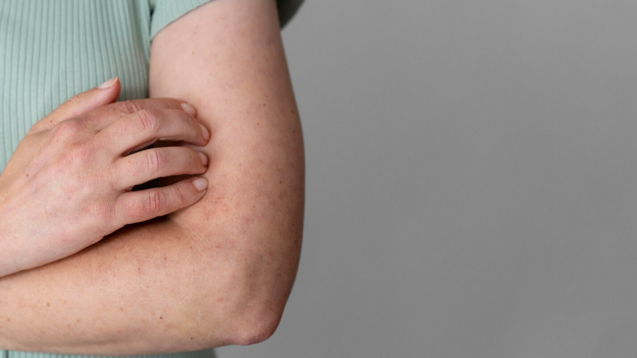 Александра Филёва объясняет, как отличить аллер...