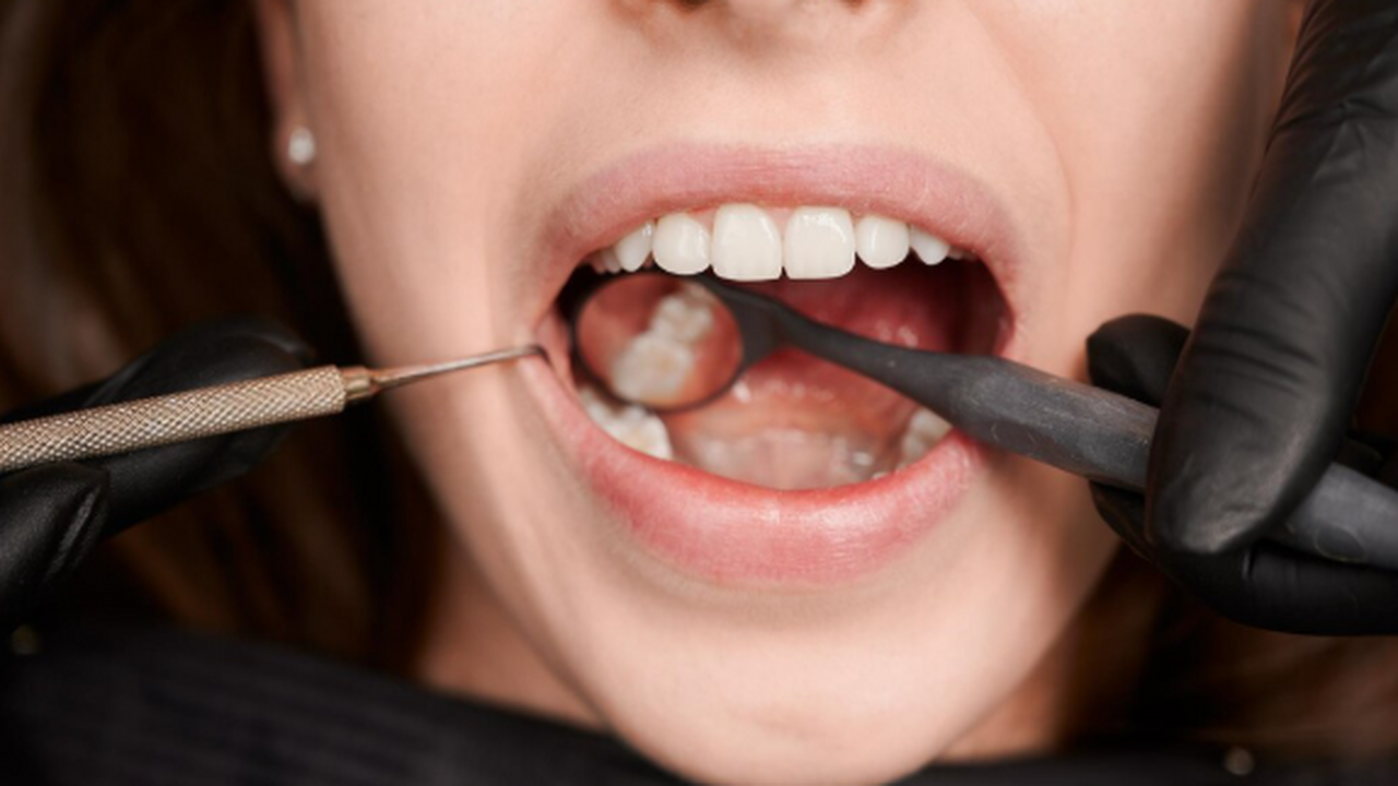 Датские ученые доказали, что аргинин подавляет кариес и зубной налет Специалисты из Орхусского университета в Дании ...