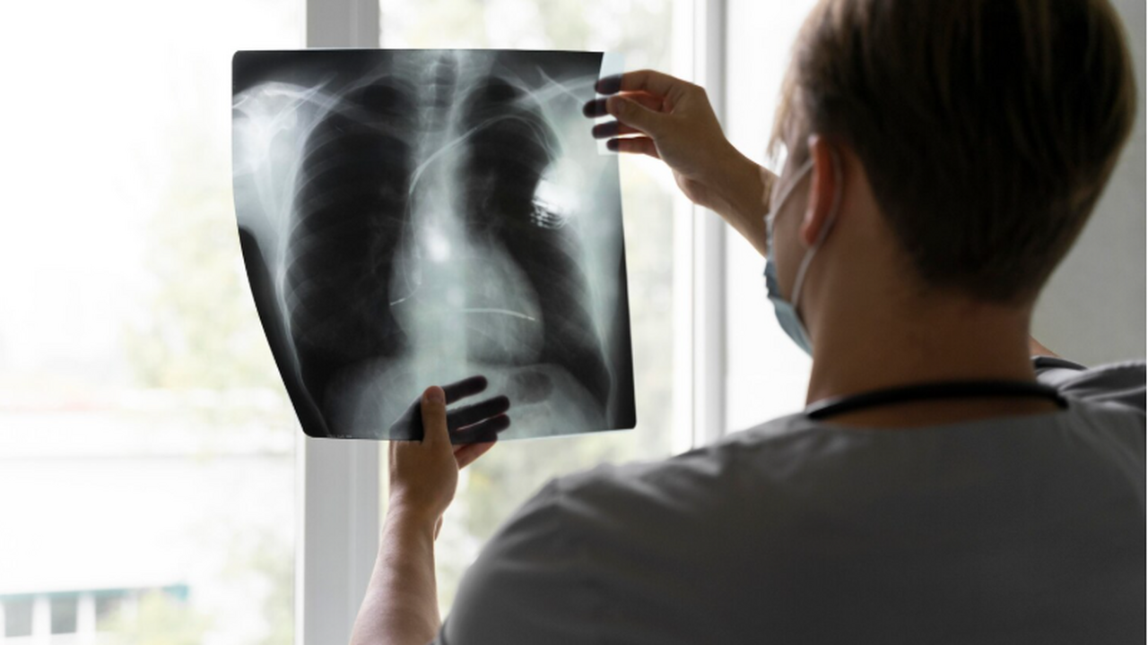 Новое исследование показало, как туберкулезная ...