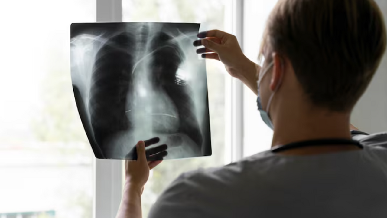 ПетрГУ совместно с турецкими учёными создал ИИ ...