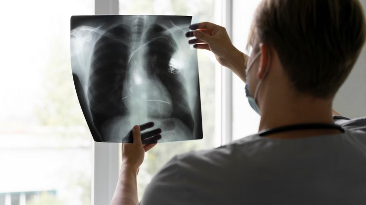 По данным Университета Вирджинии, тяжелые COVID...