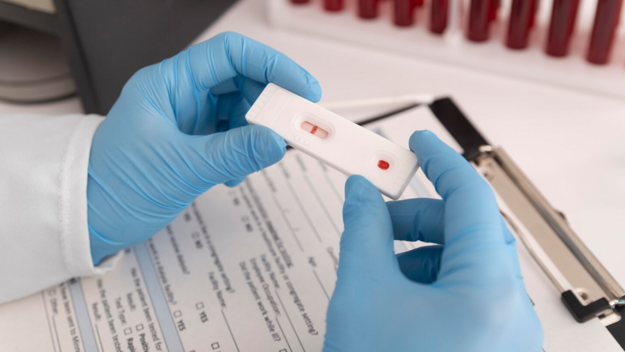 В Самарской области высокий уровень ВИЧ: регион...