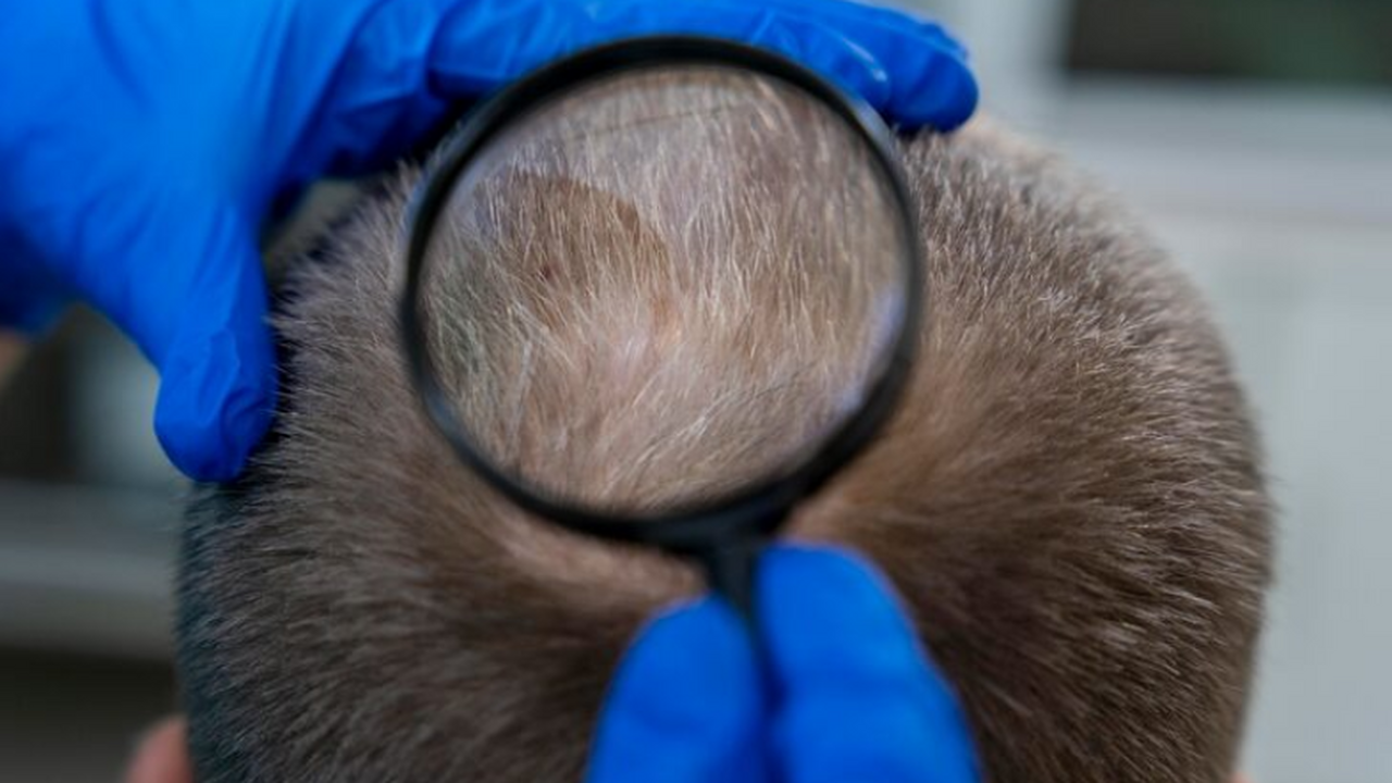 Опубликовали результаты третьей фазы клинически...