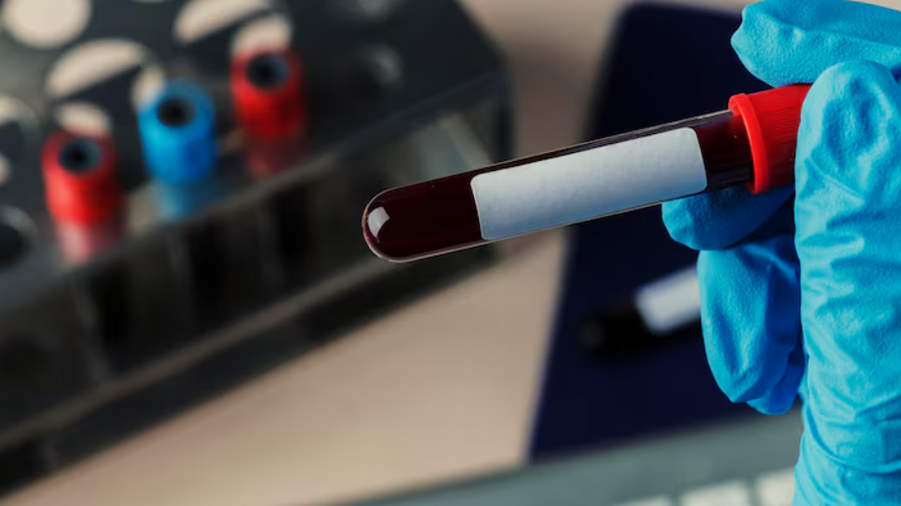 Учёные разрабатывают стратегию лечения ВИЧ чере...