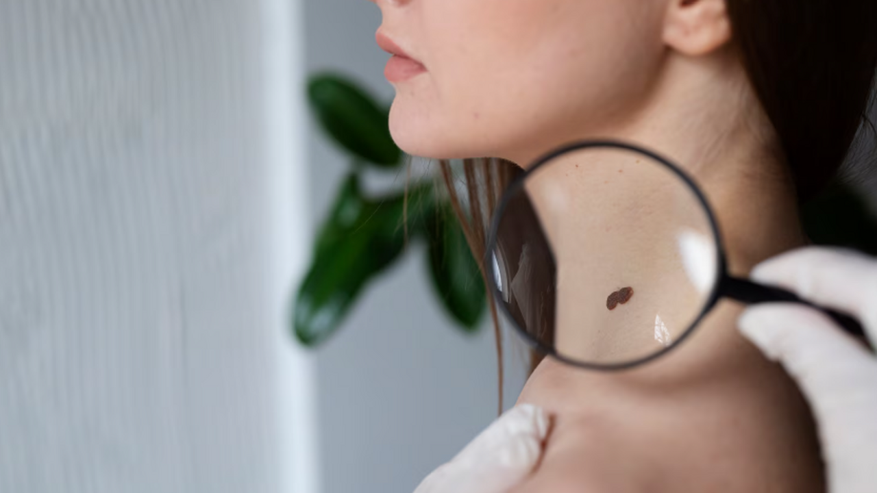 Группа учёных установила, что посещение солярие...