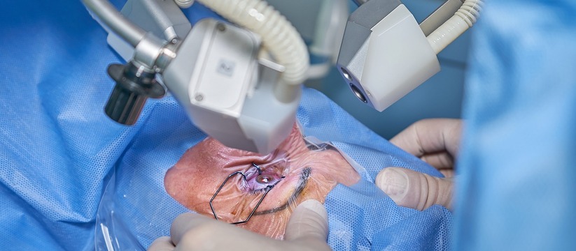 В Глазной клинике Савельева есть возможность сделать операцию по катаракте с применением импортных хрусталиков